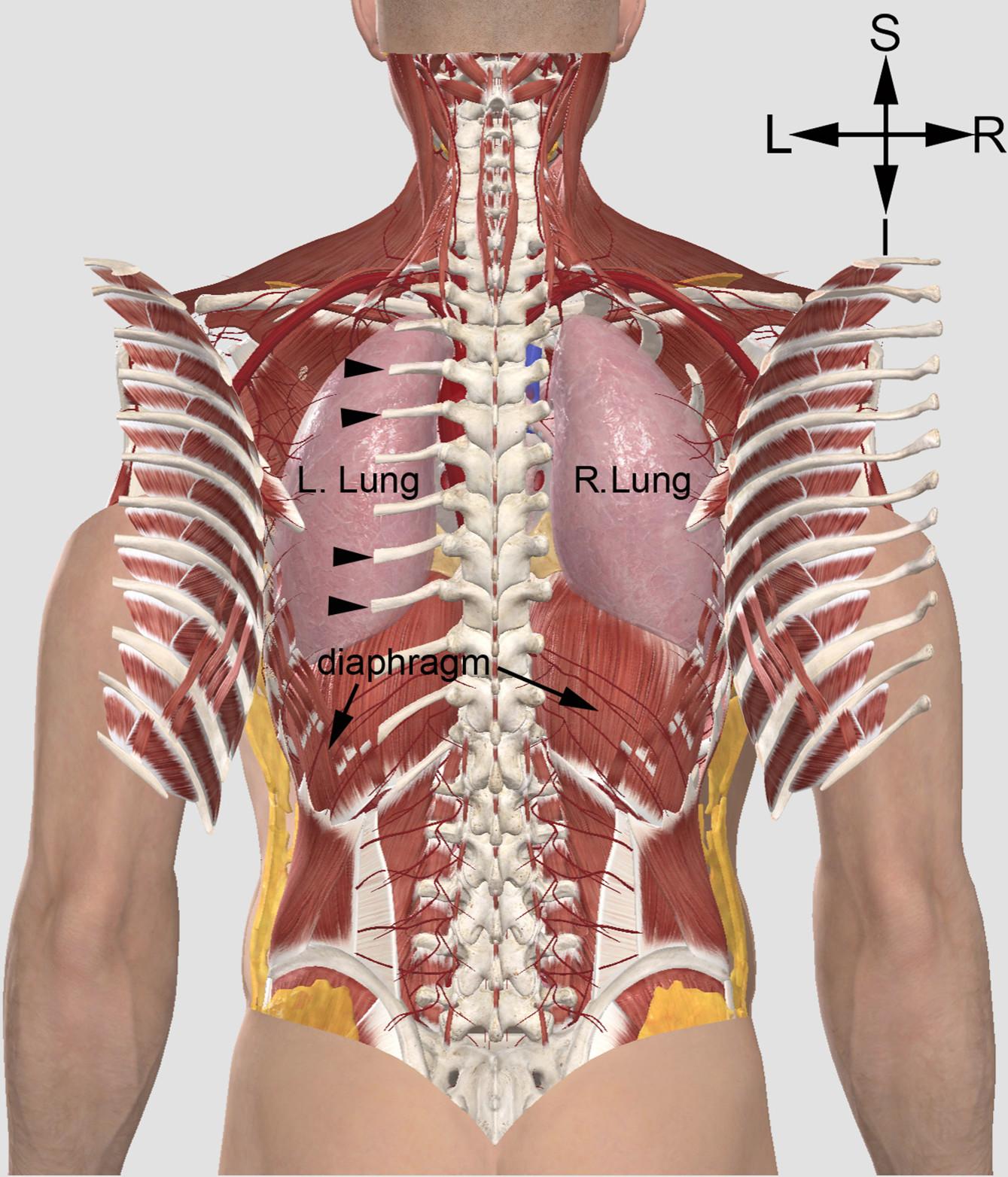 Vue du thorax avec 2 versions de fractures des côtes dans l'exécution du supplice de l'aigle de sang - Illustration: 3D4Medical - Luke John Murphy /Université d'Islande
