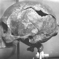 Ecosse - Photographie de 1925 du crâne découvert dans une boîte en bois à la Cathédrale St Magnus de Kirkwall - Photo: Archive des Orcades